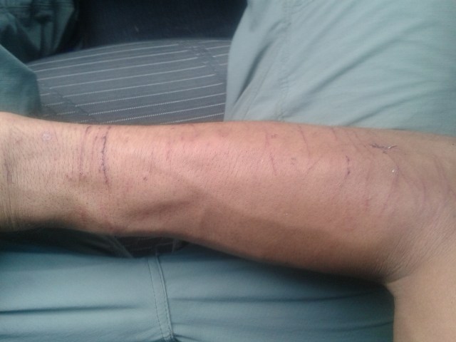 As marcas do meu amor!